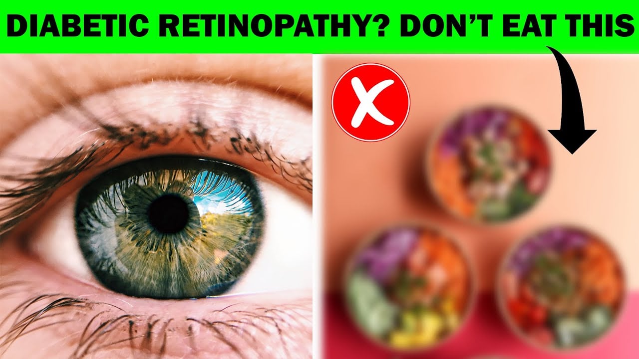Diabetic Retinopathy: 5 Healthy Food You Should Eat And 5 To Avoid